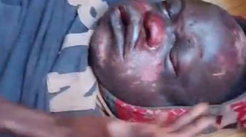 Corrupção e impunidade: Libertados seguranças da empresa Muapi Diamond acusado de assassinar homem de 59 anos na Lunda-Norte