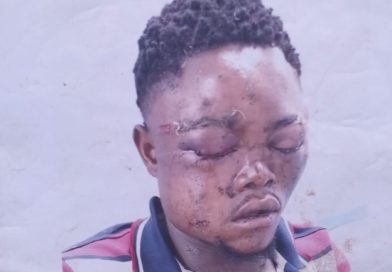 Homem que perdeu a visão após ser atingido por disparos de seguranças da empresa Capacete clama por justiça