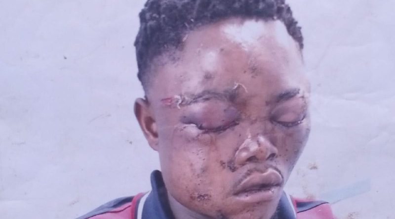 Homem que perdeu a visão após ser atingido por disparos de seguranças da empresa Capacete clama por justiça