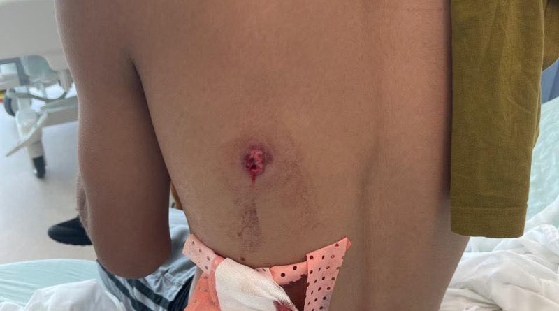 Agente da Polícia Nacional acusado de disparar contra adolescente de 15 anos em Luanda Agente da Polícia Nacional acusado de disparar contra adolescente de 15 anos em Luanda